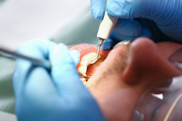 Best Emergency Denture Repair in Abilene, KS