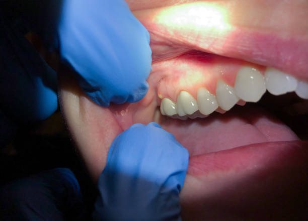 Reliable KS Emergency Dental Service Solutions